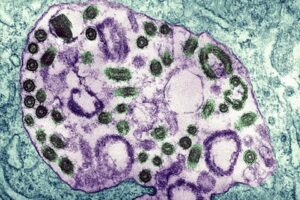 Afrika'da ge&ccedil;tiğimiz yaz mevsiminde yeniden hortlayan salgın, 2023'e girilmesiyle &uuml;&ccedil;