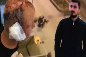 Eskişehir&rsquo;de g&uuml;r&uuml;lt&uuml; yaptığı i&ccedil;in kendisini uyaran polis memuru Ali &Uuml;.&rsquo;y&uuml;