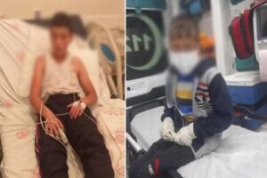 Türkiye'nin konuştuğu kuduz vakasına dair gelişmeler yakından takip ediliyor. Olay