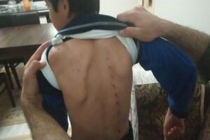Kütahya'da köpeklerle oynayan 3 çocuğa tırmıkla saldırdığı iddiasıyla gözaltına alınan