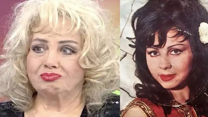 78 yaşındaki sanatçı 3 ay önce fenalaşmış ve geçirdiği felç