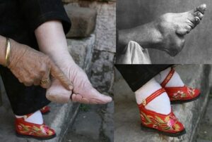 Çin‘in tarihinde, kadınlar için estetik bir ideal olan lotus ayak