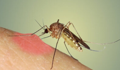 Yazın Kabus Haline Gelen Sivrisineklerden Kurtulmanın Yolu İşte Bu Kadar Basitmiş!