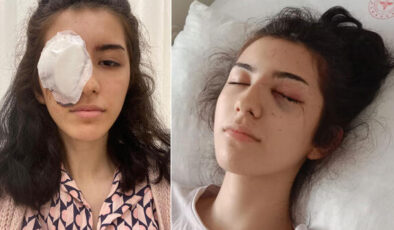 İstanbul’da maganda kurşunu 16 yaşındaki kızın gözünü kaybetmesine sebep oldu