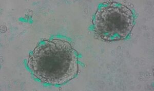 Bilim insanları, genetik mühendislikle kanser hücrelerini tespit etmek amacıyla özel