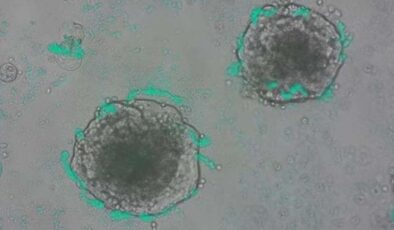 Kanser Hücrelerini Bulan Süper Bakteri: Genetik Mühendislikte Dev Adım!
