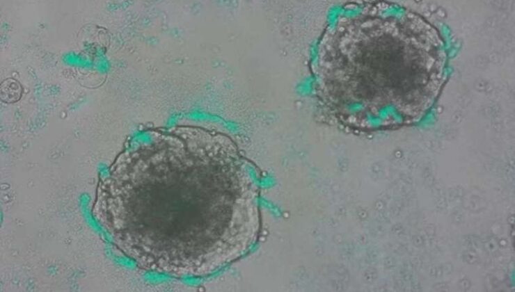 Kanser Hücrelerini Bulan Süper Bakteri: Genetik Mühendislikte Dev Adım!