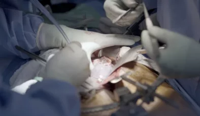 Beyin ölümü sonrası domuz böbreği nakli hastanın böbreklerini 2 ay sorunsuz çalıştırdı!