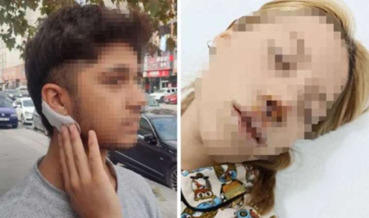 Sultangazi Eski Habipler Mahallesi’nde meydana gelen kaldırım taşlı saldırı olayı