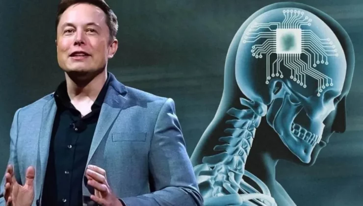Binlerce kişi Elon Musk’ın beyin çipi için sıraya girdi