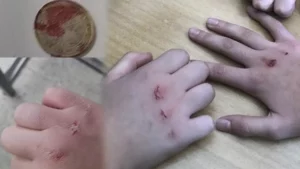 Son dönemde öğrenciler arasında giderek yaygınlaşan ve şiddet içeren ‘kanlı