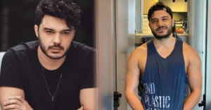 Ünlü şarkıcı İlyas Yalçıntaş, yüz felcine neden olabilen Ramsay Hunt