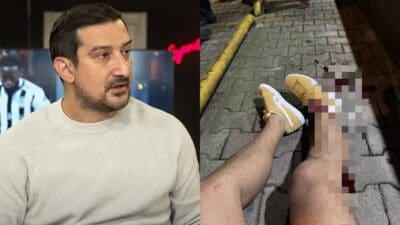 İstanbul Beykoz'da uğradığı silahlı saldırıda ayağından yaralanan eski milli futbolcu