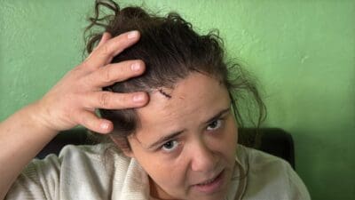 Muğla'da boşanma aşamasındaki eşi U.B. (42) tarafından darbedilen ve başına