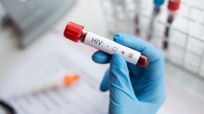 İzmir’de kemik erimesi şüphesiyle hastaneye yatırılan 13 yaşındaki çocuğun AIDS