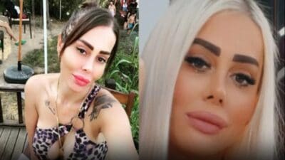İzmir'de yaşayan 32 yaşındaki Yılsu Tümen, İstanbul'da yaptırdığı yağ aldırma