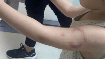 Edirne'de özel bir kreşte 3 yaşındaki çocuğu ısırdığı öne sürülen