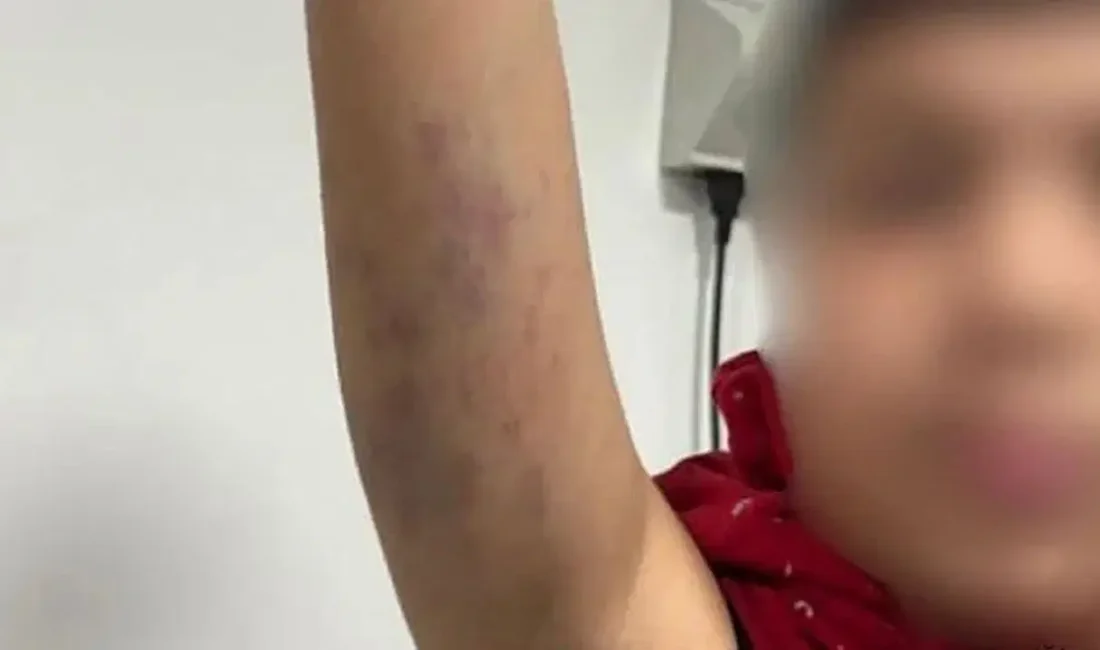 Bayrampaşa’daki bir ortaokulda, otizmli bir öğrencinin darbedildiği iddiaları gündeme geldi.