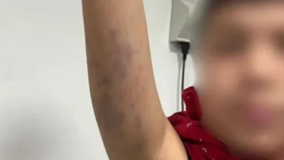 Bayrampaşa’daki bir ortaokulda, otizmli bir öğrencinin darbedildiği iddiaları gündeme geldi.