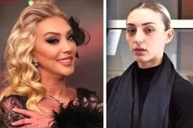 Yalova’da düşerek yaşamını yitiren şarkıcı Güllü’nün ölümüyle ilgili yürütülen soruşturmada,