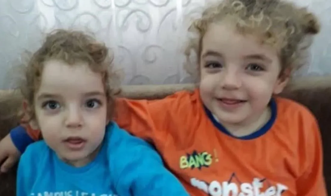 Hatay'da kalçaları yapışık doğan 9 yaşındaki siyam ikizleri Ali Haydar