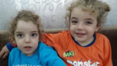 Hatay'da kalçaları yapışık doğan 9 yaşındaki siyam ikizleri Ali Haydar