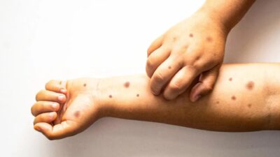 ış aylarının gelmesi ve kapalı alanlarda geçirilen sürenin artmasıyla birlikte,