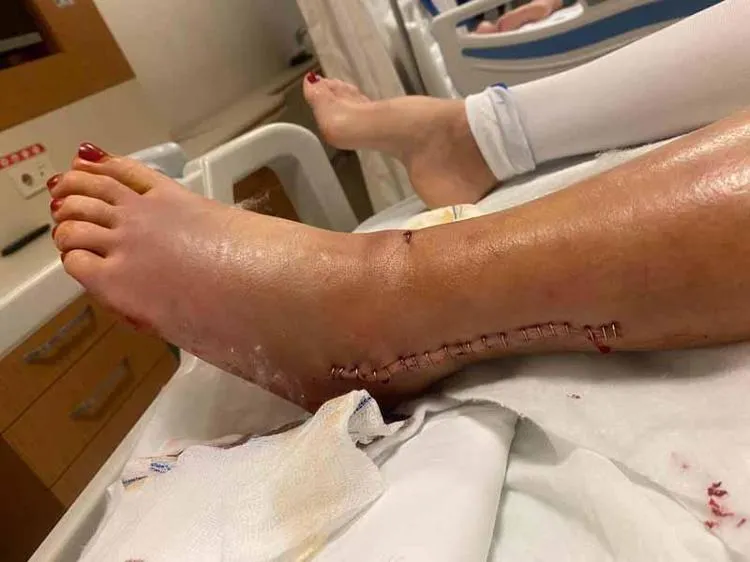 İzmir’deki kan donduran pusu: Kaza değil, katliam girişimi! 2 İzmir’deki kan donduran pusu: Kaza değil, katliam girişimi!