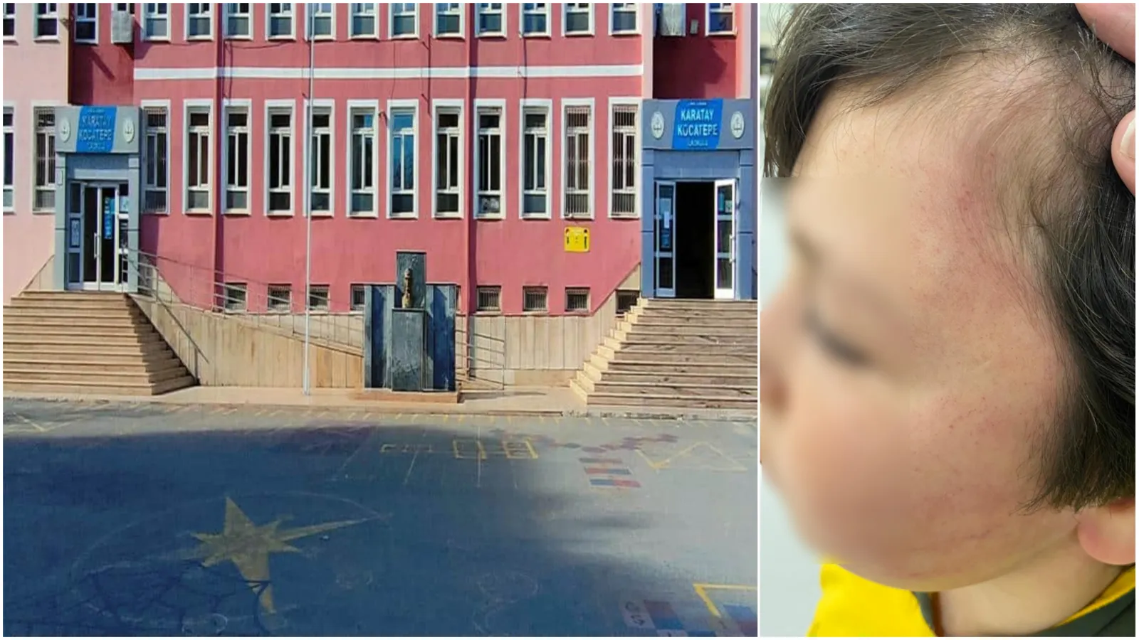 Okul değil adeta dehşet yuvası: Sınıfın ortasında 8 yaşındaki çocuğa veli şiddeti