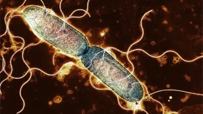 İngiltere genelinde hızla yayılan Salmonella salgını bir can aldı, yüzlerce